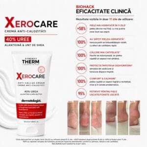 Xerocare Anti-Calluses Cream With 40% Urea, Allantoin & Shea Butter - 50ml - Image 4