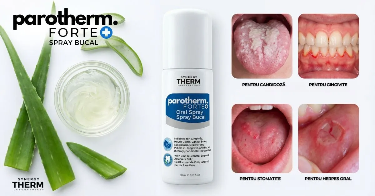 Spray oral pentru afte: cum alegi informat Spray oral pentru afte: cum alegi informat